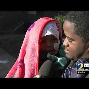 5-year-old dog attack survivor has long recovery ahead - YouTube