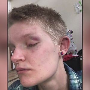 Police investigate after gay couple reports being attacked - YouTube